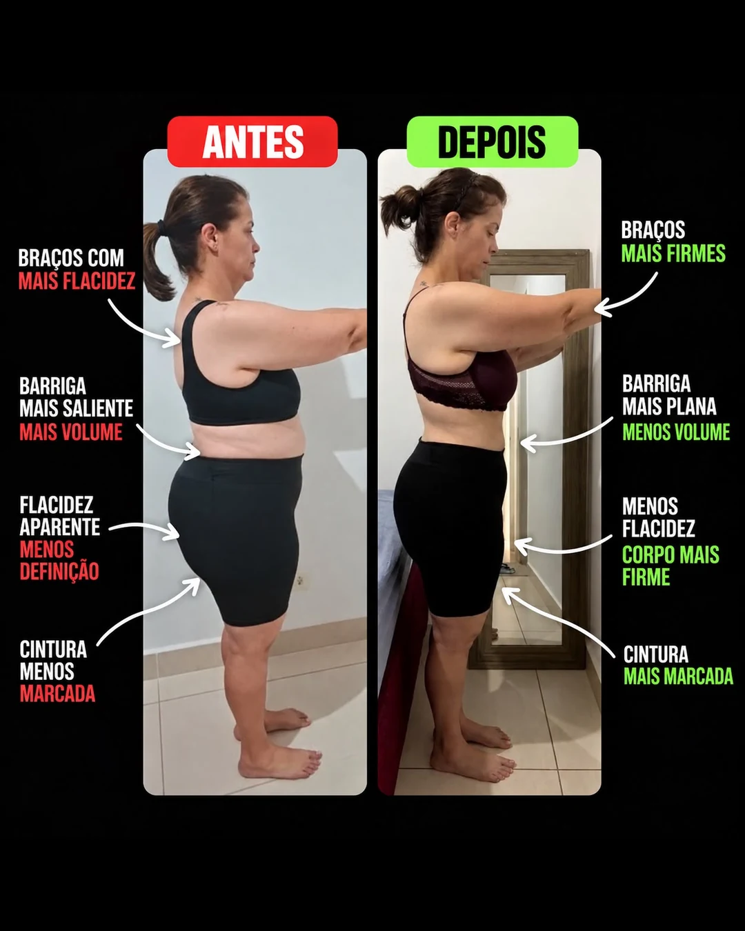 Aluna do Desafio Rapido Antiflacidez: comparativo antes e depois, com menos flacidez e cintura mais marcada