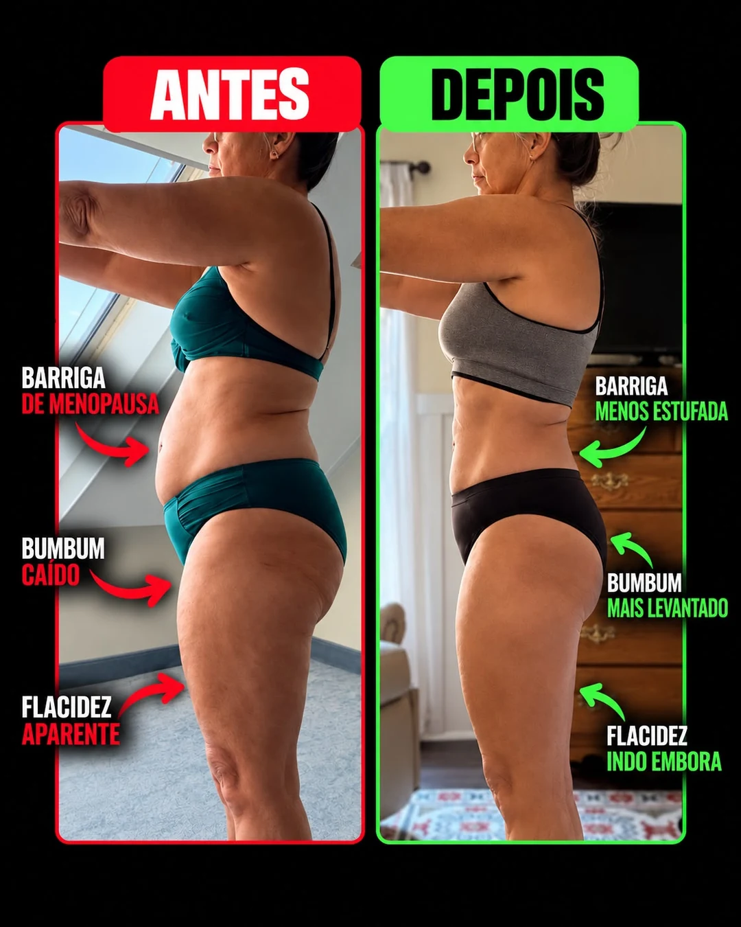 Aluna do Desafio Rapido Antiflacidez: comparativo antes e depois, com menos flacidez e cintura mais marcada