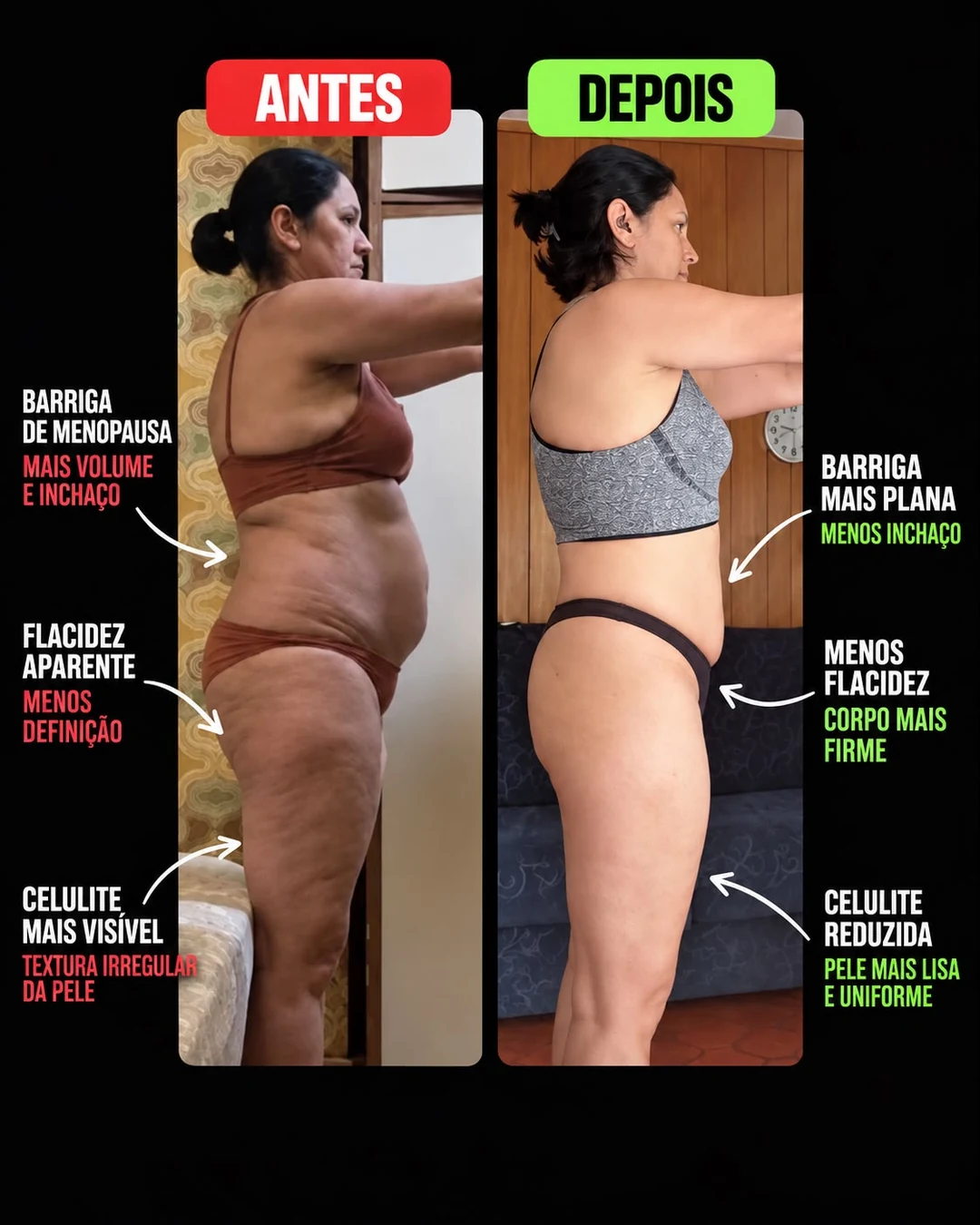 Aluna do Desafio Rapido Antiflacidez: comparativo antes e depois, com menos flacidez e cintura mais marcada